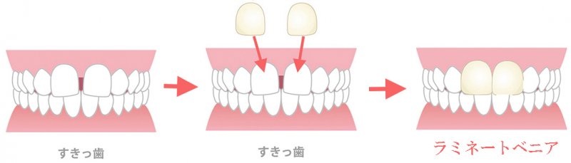 医療法人社団スマイル会 ふかさわ歯科クリニック篠崎 ニュース画像1