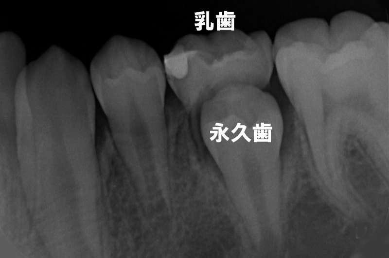 医療法人社団スマイル会 ふかさわ歯科クリニック篠崎 ニュース画像1