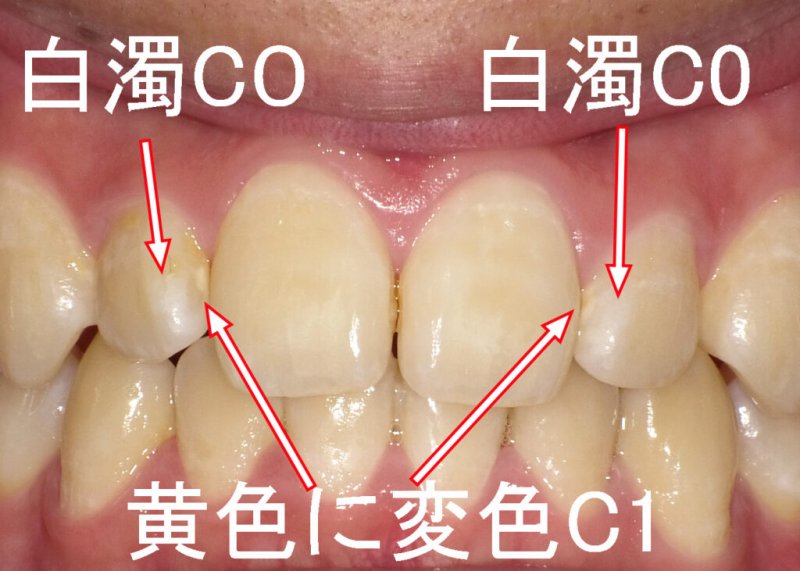 医療法人社団スマイル会 ふかさわ歯科クリニック篠崎 ニュース画像1