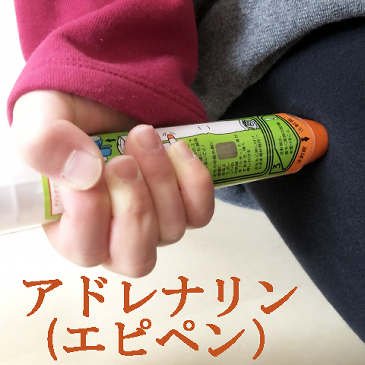 アナフィラキシーショックとは?症状・原因・緊急対応 ニュース画像1