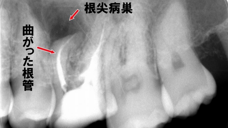 医療法人社団スマイル会 ふかさわ歯科クリニック篠崎 ニュース画像1