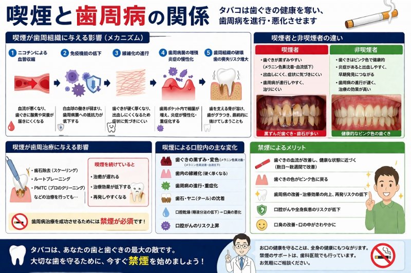タバコと歯周病の深刻な関係｜喫煙が口腔に及ぼす影響 ニュース画像1