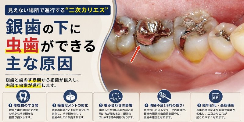医療法人社団スマイル会 ふかさわ歯科クリニック篠崎 ニュース画像1