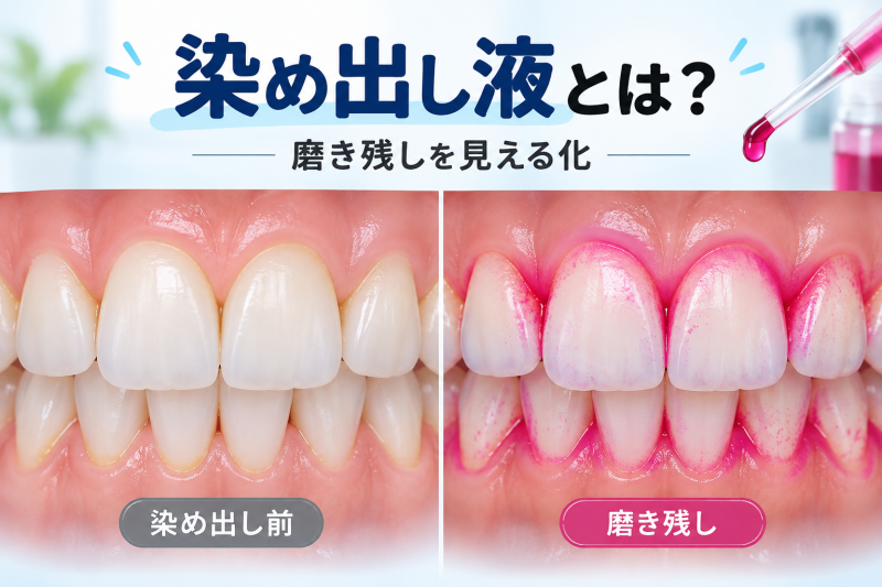 歯垢染め出し液とは?磨き残しが赤く染まる仕組みと使い方 ニュース画像1